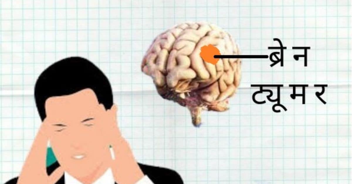 ब्रेन ट्यूमर की लास्ट स्टेज, लक्षण व इलाज - brain tumour in hindi