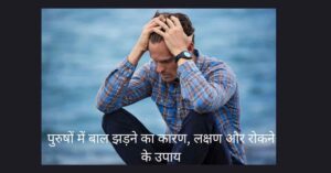 पुरुषों में बाल झड़ने 